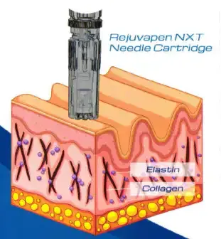 Diagram of the Rejuvapen NXT needle cartridge reaching the collagen and elastin layer of skin.