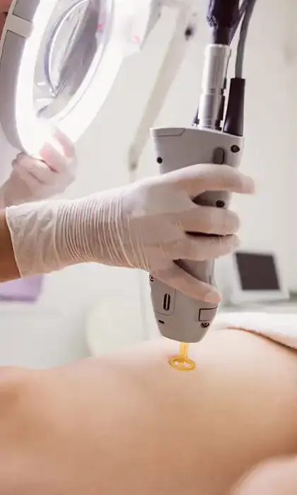 A PicoSure treatment being performed at Vada Spa.